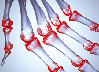 <!–:tr–>Eklem İltihabı ve Süt mü?<!–:–>